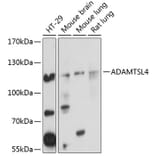 Western Blot - Anti-ADAMTSL4 Antibody (A14601) - Antibodies.com