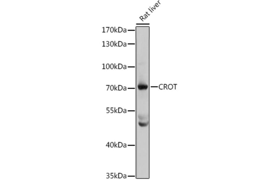 Western Blot - Anti-CROT/COT Antibody (A14602) - Antibodies.com