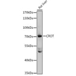 Western Blot - Anti-CROT/COT Antibody (A14602) - Antibodies.com