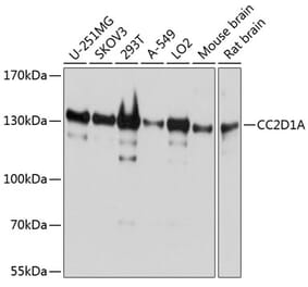 Western Blot - Anti-CC2D1A Antibody (A14603) - Antibodies.com