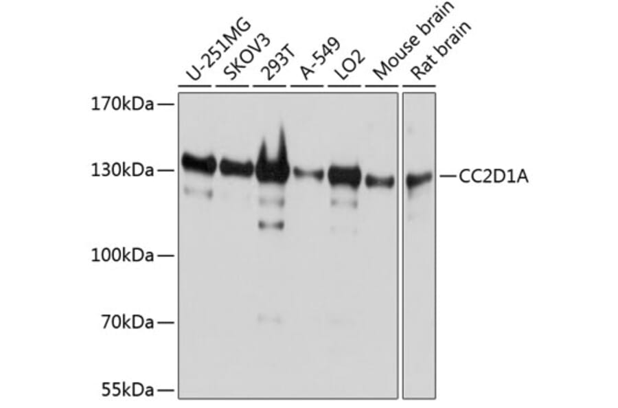 Western Blot - Anti-CC2D1A Antibody (A14603) - Antibodies.com