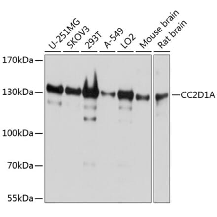 Western Blot - Anti-CC2D1A Antibody (A14603) - Antibodies.com