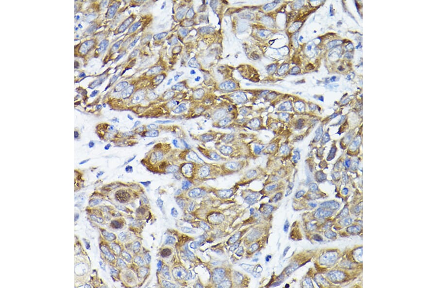 Immunohistochemistry - Anti-CC2D1A Antibody (A14603) - Antibodies.com
