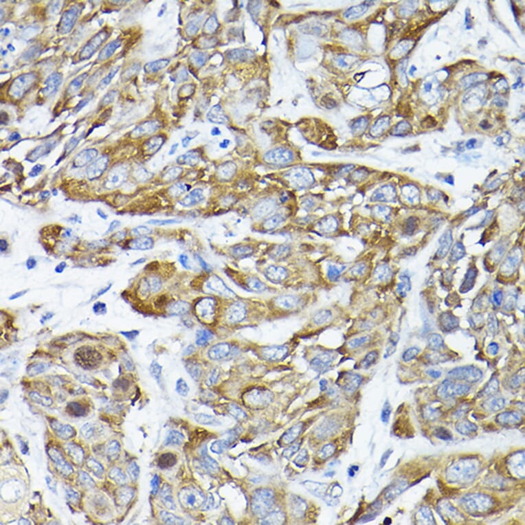 Immunohistochemistry - Anti-CC2D1A Antibody (A14603) - Antibodies.com