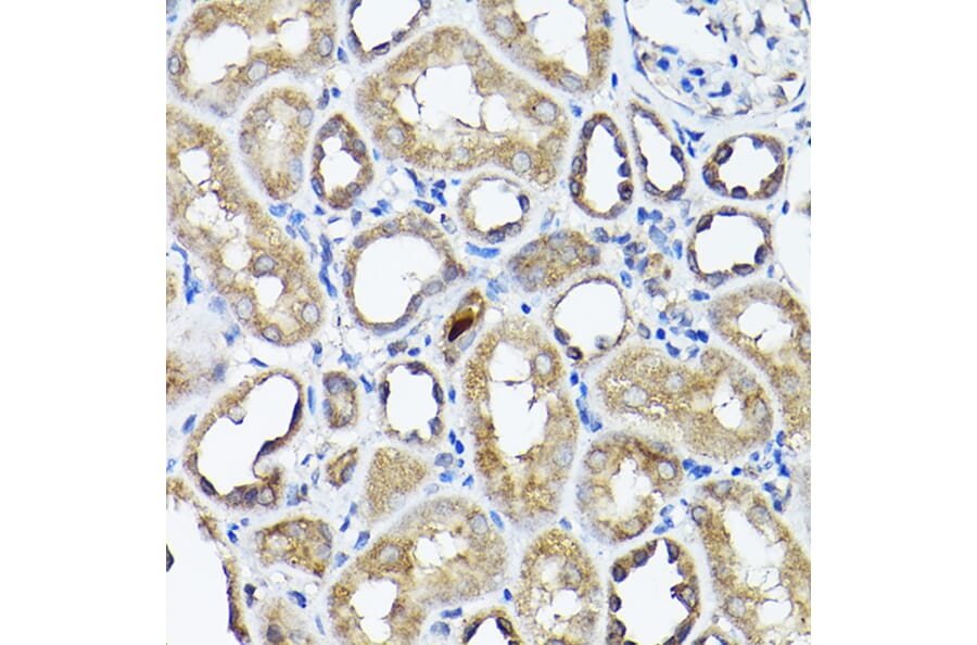 Immunohistochemistry - Anti-CC2D1A Antibody (A14603) - Antibodies.com