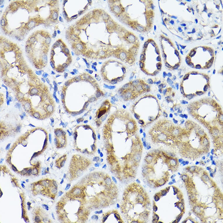 Immunohistochemistry - Anti-CC2D1A Antibody (A14603) - Antibodies.com