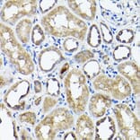 Immunohistochemistry - Anti-CC2D1A Antibody (A14603) - Antibodies.com