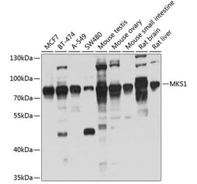 Western Blot - Anti-MKS1 Antibody (A14604) - Antibodies.com