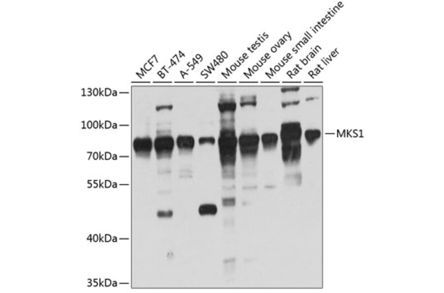 Western Blot - Anti-MKS1 Antibody (A14604) - Antibodies.com