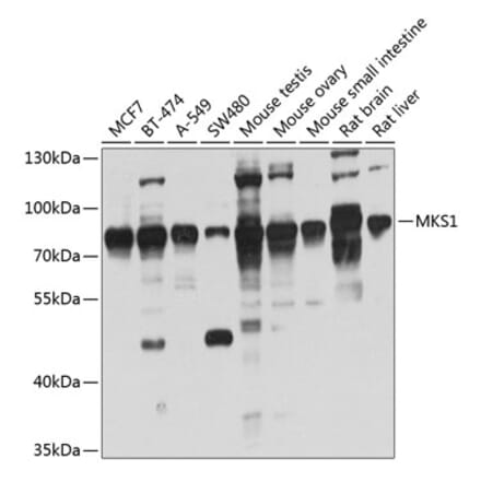 Western Blot - Anti-MKS1 Antibody (A14604) - Antibodies.com