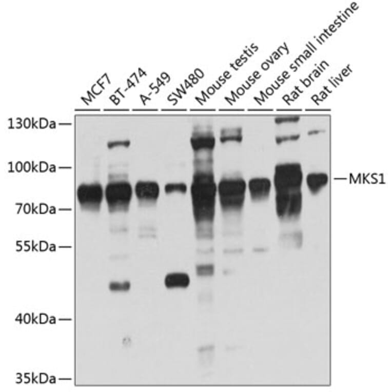 Western Blot - Anti-MKS1 Antibody (A14604) - Antibodies.com