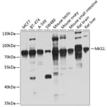 Western Blot - Anti-MKS1 Antibody (A14604) - Antibodies.com