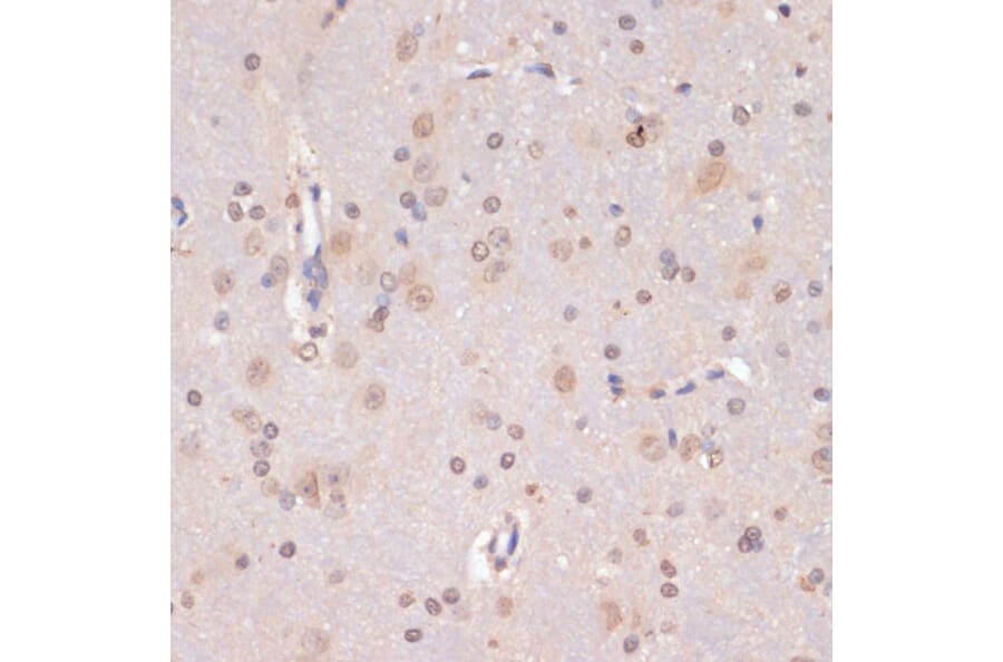 Immunohistochemistry - Anti-PIDD1 Antibody (A14605) - Antibodies.com