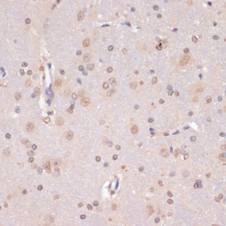 Immunohistochemistry - Anti-PIDD1 Antibody (A14605) - Antibodies.com