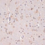 Immunohistochemistry - Anti-PIDD1 Antibody (A14605) - Antibodies.com