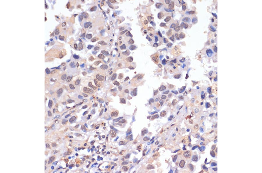 Immunohistochemistry - Anti-PIDD1 Antibody (A14605) - Antibodies.com
