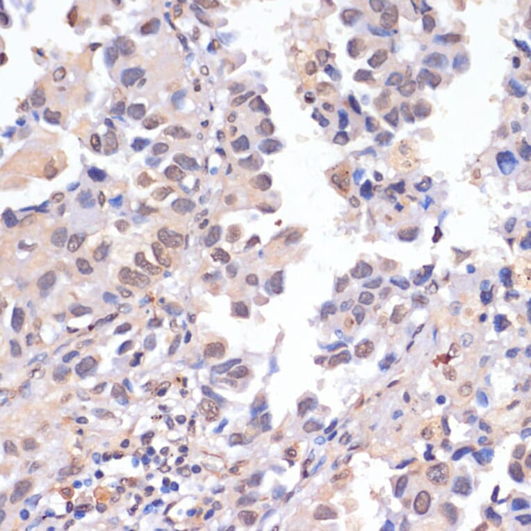 Immunohistochemistry - Anti-PIDD1 Antibody (A14605) - Antibodies.com