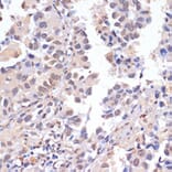 Immunohistochemistry - Anti-PIDD1 Antibody (A14605) - Antibodies.com