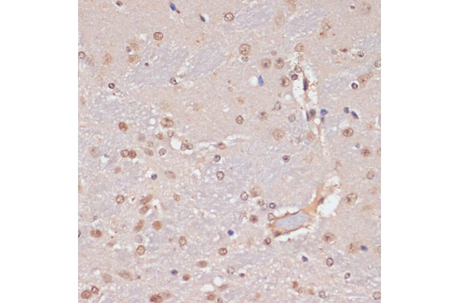 Immunohistochemistry - Anti-PIDD1 Antibody (A14605) - Antibodies.com