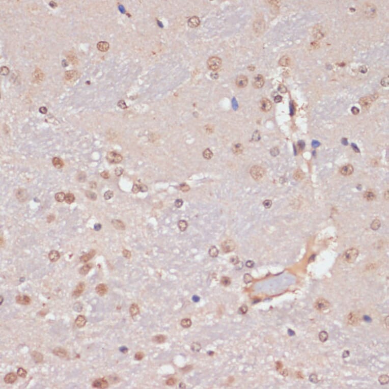 Immunohistochemistry - Anti-PIDD1 Antibody (A14605) - Antibodies.com