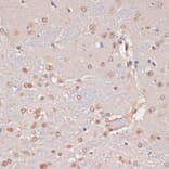 Immunohistochemistry - Anti-PIDD1 Antibody (A14605) - Antibodies.com