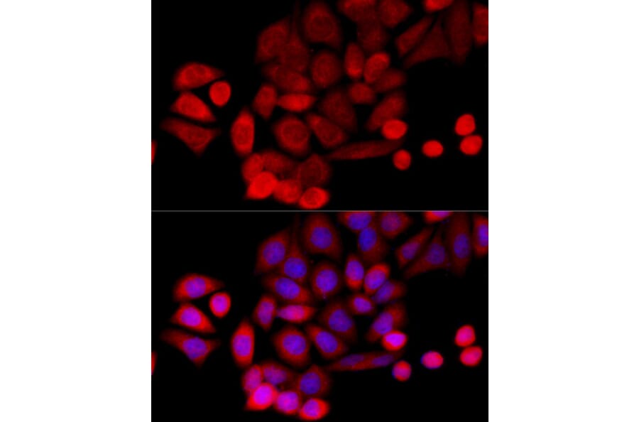 Immunofluorescence - Anti-PIDD1 Antibody (A14605) - Antibodies.com