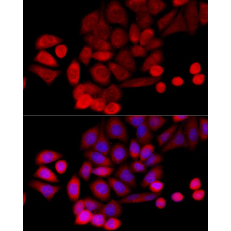 Immunofluorescence - Anti-PIDD1 Antibody (A14605) - Antibodies.com