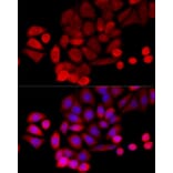 Immunofluorescence - Anti-PIDD1 Antibody (A14605) - Antibodies.com