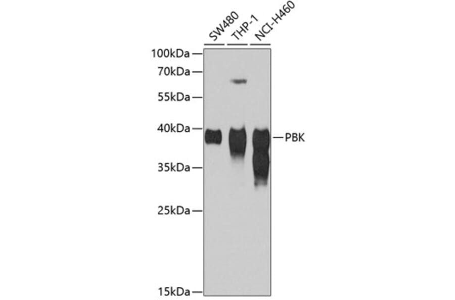 Western Blot - Anti-PBK/SPK Antibody (A14606) - Antibodies.com
