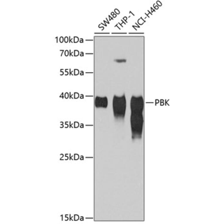 Western Blot - Anti-PBK/SPK Antibody (A14606) - Antibodies.com