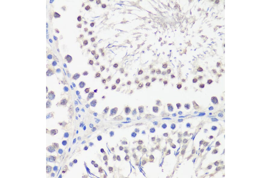 Immunohistochemistry - Anti-PBK/SPK Antibody (A14606) - Antibodies.com