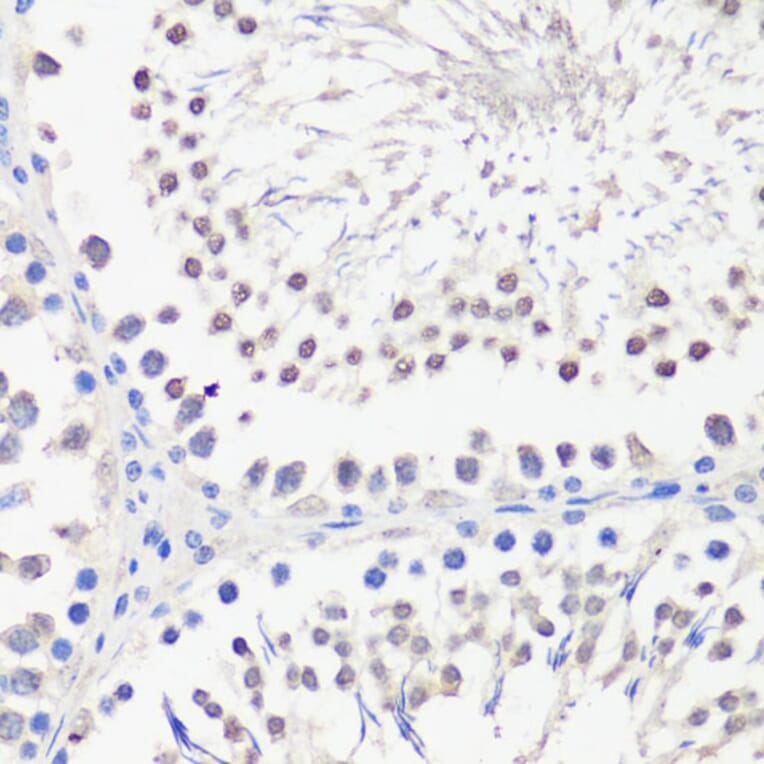 Immunohistochemistry - Anti-PBK/SPK Antibody (A14606) - Antibodies.com