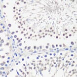 Immunohistochemistry - Anti-PBK/SPK Antibody (A14606) - Antibodies.com