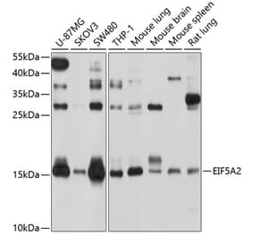 Western Blot - Anti-eIF5A2 Antibody (A14607) - Antibodies.com