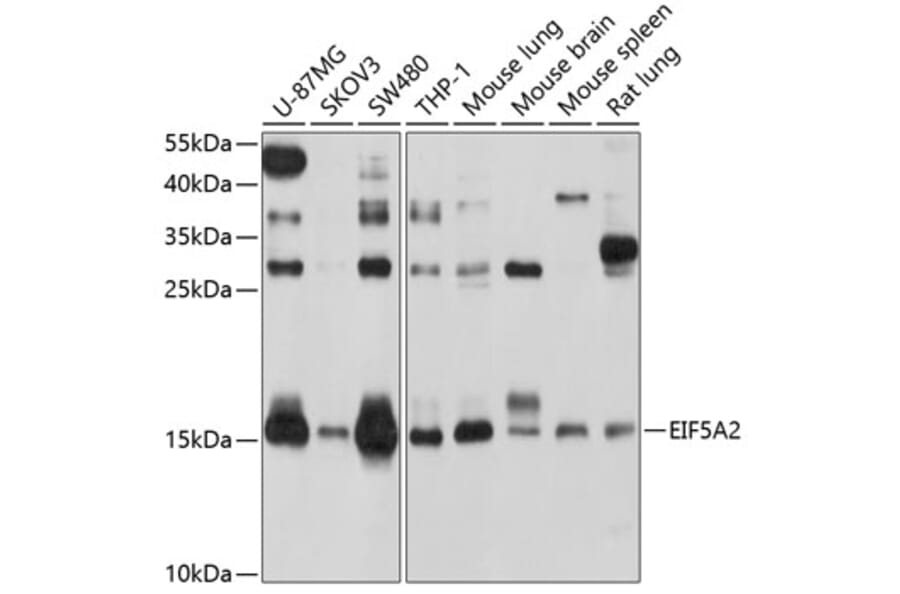 Western Blot - Anti-eIF5A2 Antibody (A14607) - Antibodies.com