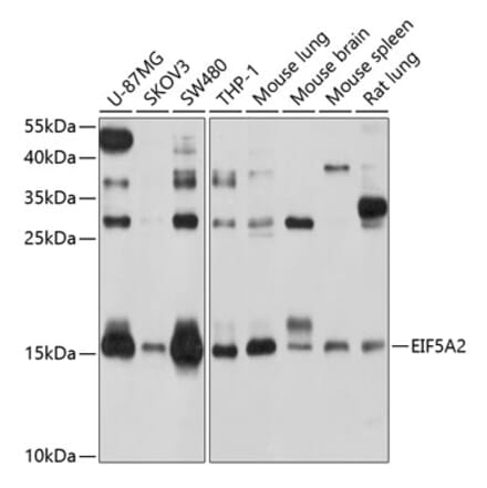 Western Blot - Anti-eIF5A2 Antibody (A14607) - Antibodies.com