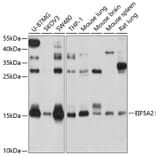 Western Blot - Anti-eIF5A2 Antibody (A14607) - Antibodies.com