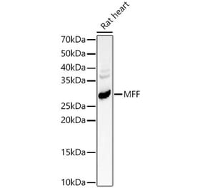 Western Blot - Anti-MFF Antibody (A14609) - Antibodies.com