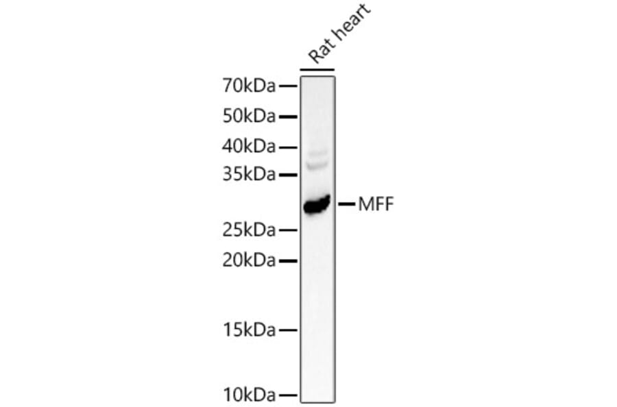 Western Blot - Anti-MFF Antibody (A14609) - Antibodies.com