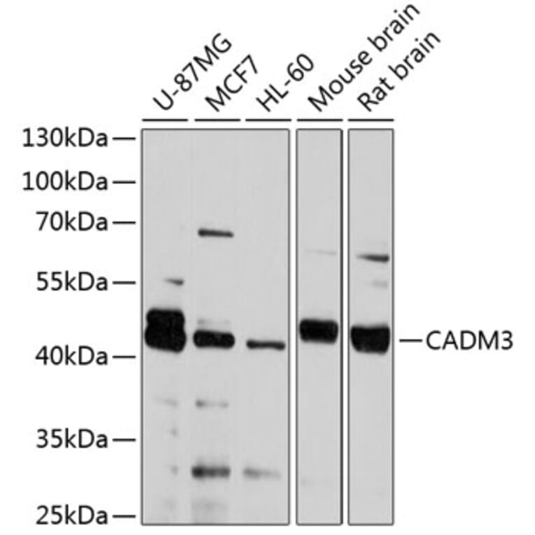 Western Blot - Anti-NECL-1 Antibody (A14610) - Antibodies.com