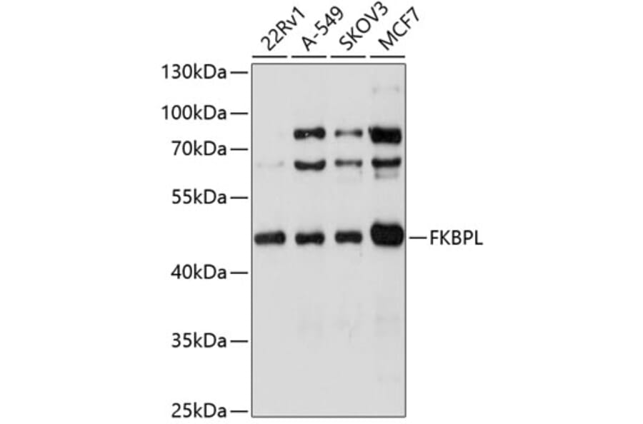 Western Blot - Anti-FKBPL Antibody (A4916) - Antibodies.com