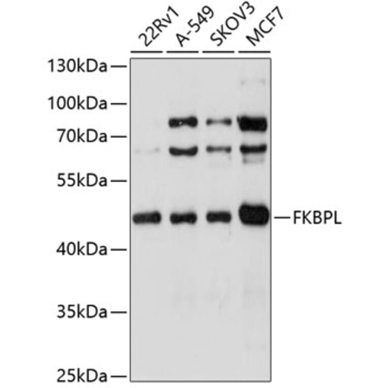 Western Blot - Anti-FKBPL Antibody (A4916) - Antibodies.com