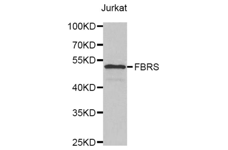 Western Blot - Anti-FBRS Antibody (A4927) - Antibodies.com