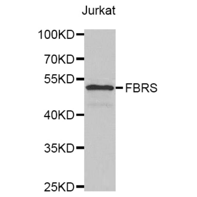 Western Blot - Anti-FBRS Antibody (A4927) - Antibodies.com