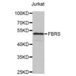 Western Blot - Anti-FBRS Antibody (A4927) - Antibodies.com