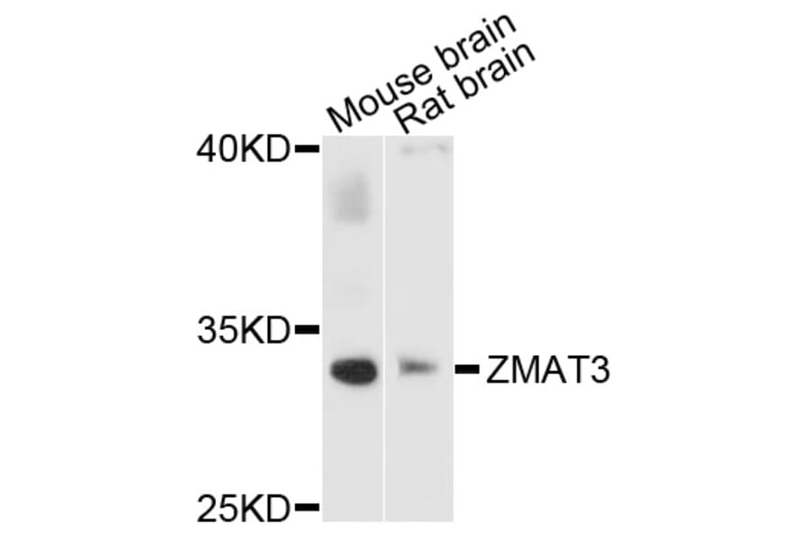 Western Blot - Anti-ZMAT3 Antibody (A4928) - Antibodies.com