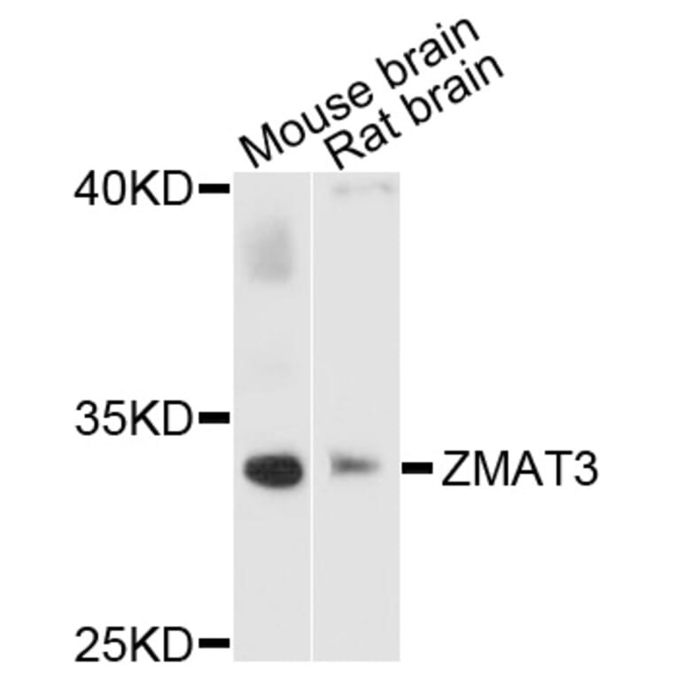 Western Blot - Anti-ZMAT3 Antibody (A4928) - Antibodies.com