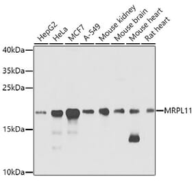 Western Blot - Anti-Mitochondrial ribosomal protein L11 Antibody (A14614) - Antibodies.com
