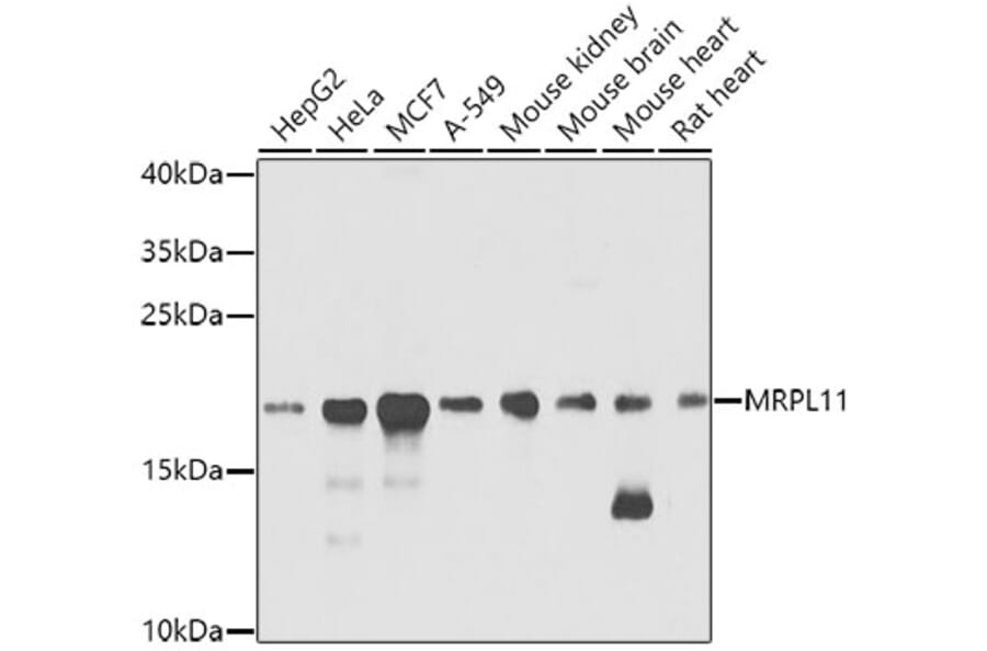 Western Blot - Anti-Mitochondrial ribosomal protein L11 Antibody (A14614) - Antibodies.com