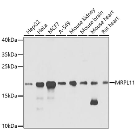 Western Blot - Anti-Mitochondrial ribosomal protein L11 Antibody (A14614) - Antibodies.com